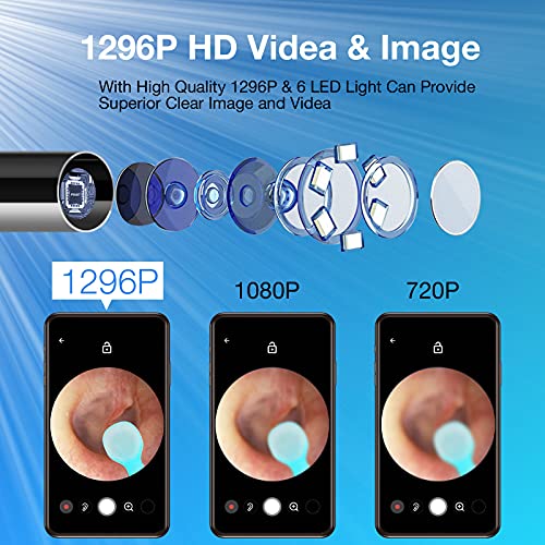 Ear-Wax-Removal-with-Camera-Earwax-Remover-Tool-1296P-FHD-Wireless-Ear-Otoscope-with-6-LED-Lights-6-Ear-Spoon-6-Traditional-Tools-Ear-Wax-Removal-Kit-for-iPhone-iPad-Android-Smart-Phone